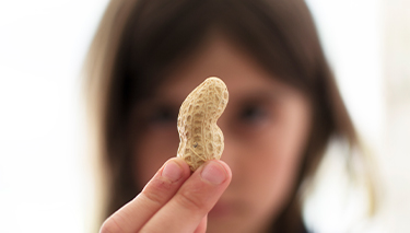Peanut allergy