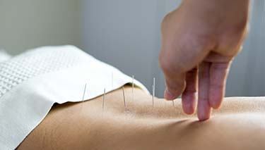 Acupuncture_Desktop Article Pages 375x213px