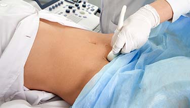 Fertility treatment