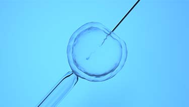 IVF