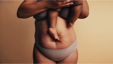 Your Post Pregnancy Body That People Dont Talk About