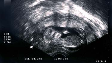 12 Week