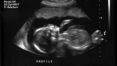20_week_US_Desktop Article Pages 375x213px