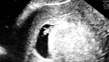 6 Week