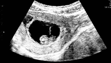 7 Week