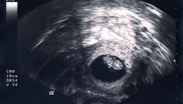8 Week