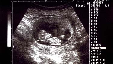 9 Week