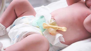 Cord blood donation